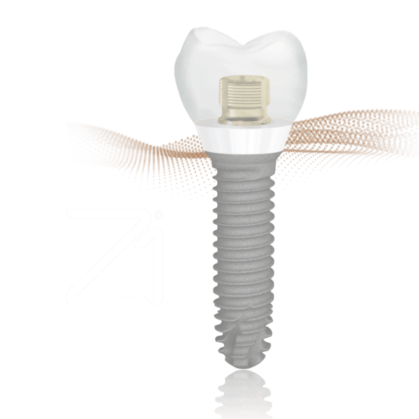 Z1 Tissue Level Implants - TBR Dental